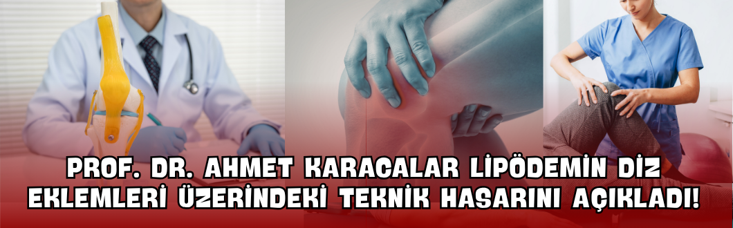 Prof. Dr. Ahmet Karacalar Lipödemin Diz Eklemleri Üzerindeki Teknik Hasarını Açıkladı!